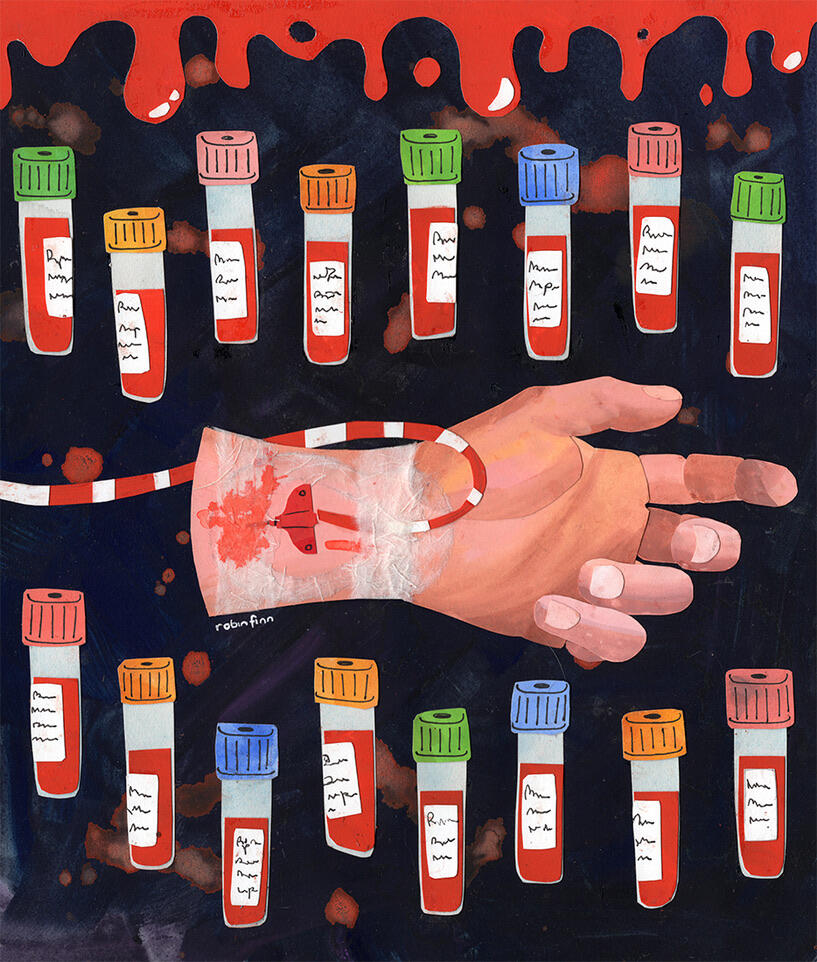 Gouache and cut paper collage of a hand with an arterial wrist catheter, against a dark background splattered with red, surrounded by test tube vials of blood.